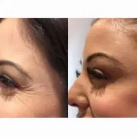 جراحی بینی بدون تامپون با ۲۵ سال سابقه|خدمات آرایشگری و زیبایی|کرج, مهرویلا جنوبی|دیوار