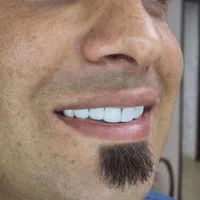 اگر مروارید هات زرد شده یا شکسته زیرکونیوم کن|آرایشی، بهداشتی، درمانی|گرگان, |دیوار