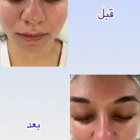 پاکسازی پوست و ماساژ ریلکسی درمانی