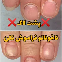 سرم تقویت ناخن اصل نمایندگی بردسیر|آرایشی، بهداشتی، درمانی|بردسیر, |دیوار