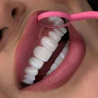 کامپوزیت دندان در تهران/طراحی لبخند|خدمات زیبایی و سلامت|تهران, کاشانک|دیوار