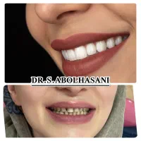 جشنواره لمینت فقط با ده تومن پیش پرداخت اصفهان|خدمات آرایشگری و زیبایی|شهرکرد, |دیوار