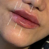 کلینیک زیبایی تخصصی بوتاکس،فیلر، ژل با 15سال سابقه