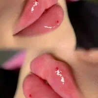 لیزر موهای زائد تضمینی بوتاکس و فیلر زیر نظر پزشک