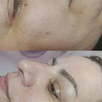فیشال تخصصی (فرصت استثنایی)|خدمات آرایشگری و زیبایی|مشهد, تلگرد|دیوار
