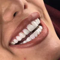 خدمات درمانی و زیبایی فکی ۹میلیون