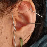 کلیه خدمات طب سنتی و طب سوزنی