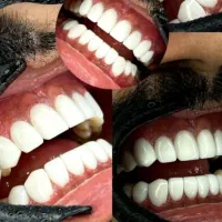۱۶واحد برند و متریال درجه یک فقط ۱۶/۰۰۰