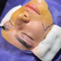 بلفاروپلاستی،لیفت ابرو،لیفت شقیقه،دایرکت ابرو|خدمات آرایشگری و زیبایی|ارومیه, |دیوار