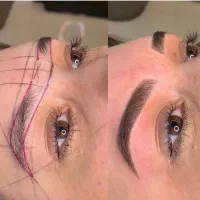 فیبروز ابرو،میکروبلیدینگ ابرو