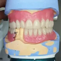 ساخت دندان مصنوعی