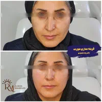 جشنواره  زیبایی کلینیک دکتر محمودی|خدمات آرایشگری و زیبایی|کرمان, |دیوار