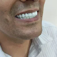 دندانسازی (فقط با ۱۵ میلیون )|خدمات آرایشگری و زیبایی|پرند, فاز ۲|دیوار