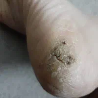 درمان|آرایشی، بهداشتی، درمانی|مشهد, کارمندان دوم|دیوار