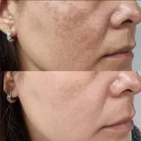 قوی ترین ضد لک دنیا
