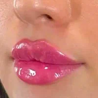فیلر لب زیر چشم فیلر بادی نخ لیفت پی ار پی مزو|خدمات آرایشگری و زیبایی|اصفهان, سیچان|دیوار