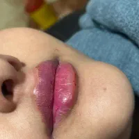 ژل بوتاکس|خدمات آرایشگری و زیبایی|دورود, |دیوار