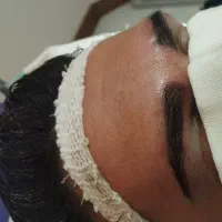 کاشت ابرو بدون جراحی و با جراحی تیم از تهران|خدمات آرایشگری و زیبایی|رشت, گلسار|دیوار