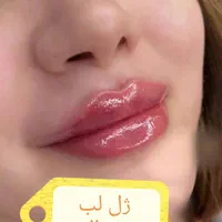 خدمات تخصصی ژل بوتاکس لیزر در کلینیک پزشکی|خدمات آرایشگری و زیبایی|شیراز, ارم|دیوار