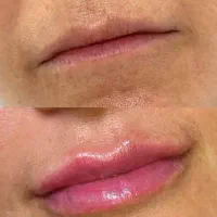 کلینیک تخصصی پوست و زیبایی|خدمات آرایشگری و زیبایی|شیراز, ارم|دیوار