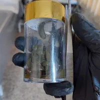 حجامت و زالو درمانی و طب سوزنی و بادکش|خدمات آرایشگری و زیبایی|ارومیه, |دیوار