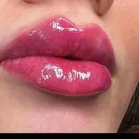 لیزر موهای زائدالکساندرایت‌کندلاآمریکایی‌اصل|خدمات آرایشگری و زیبایی|اندیشه, اندیشه فاز ۱|دیوار