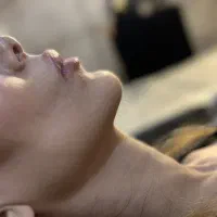 تخفیف ویژه روی کلیه کارهای زیبایی فیلر و بوتاکس|خدمات آرایشگری و زیبایی|شیراز, تاچارا|دیوار