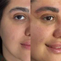 مدل رایگان میکروبلیدینگ و شیدینگ|خدمات آرایشگری و زیبایی|تهران, نیلوفر|دیوار