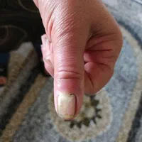 مرکز تخصصی انواع زخم و چند تخصصی|خدمات آرایشگری و زیبایی|تهران, ائمه اطهار|دیوار
