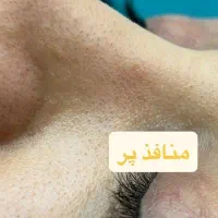 پارافین تراپی کربوکسی فیشال پاکسازی