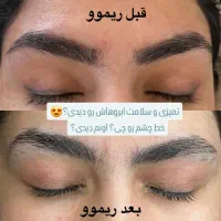 ریمو ابرو بدون زخم|خدمات آرایشگری و زیبایی|دهدشت, |دیوار