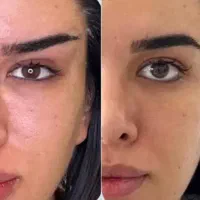 تخفیف عمل بینی لیفت/لیپو/ابدو/رفع غبغب/دایرکت ابرو|خدمات آرایشگری و زیبایی|پاکدشت, شهرک انقلاب|دیوار