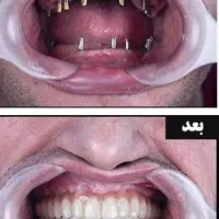 خدمات پیشرفته و تخصصی دندانپزشکی