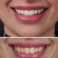 جشنواره یلدایی خدمات دندانپزشکی شهر سهند|خدمات آرایشگری و زیبایی|سهند, |دیوار