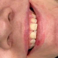 خدمات دندان پزشکی با تخفیف ویژه پاییز ( 50٪ )سنندج|خدمات آرایشگری و زیبایی|مریوان, |دیوار