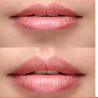 کلینیک تخصصی زیبایی دکتر فولادی|خدمات آرایشگری و زیبایی|دوگنبدان, |دیوار