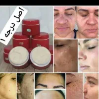 کرم معجزه اصل با گارانتی مرجوعی