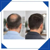 شروع متفاوت 40 روزه