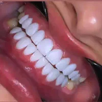 آموزش کامپوزیت