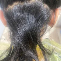 رفع قطعی شپش