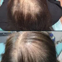 اعتماد به نفس از دست رفته تو با موهات برگردون