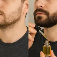 روغن پر پشت کننده ریش معجزه