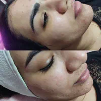 آموزش پاکسازی فیشال درمان جوش و لک پروتئین تراپی|خدمات آرایشگری و زیبایی|اهواز, کیانپارس |دیوار