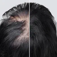 پی ار پی خال برداری پرسینگ|خدمات آرایشگری و زیبایی|مشهد, شفا|دیوار