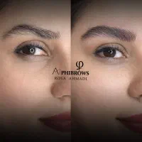 فیبروز ابرو با بهترین کیفیت