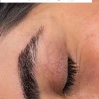 ریموو تک جلسه  با تخفیف ویژه|خدمات آرایشگری و زیبایی|تربت جام, پاسداران|دیوار