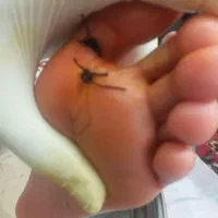 انواع تزریقات وپانسمان فصدبخیه وفیزیوتراپی درمنزل|خدمات آرایشگری و زیبایی|خرم‌آباد, |دیوار