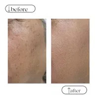 تزریق ژل و بوتاکس، ژل لب روسی و آموزش و ارائه مدرک|خدمات آرایشگری و زیبایی|کرج, شاهین‌ویلا|دیوار