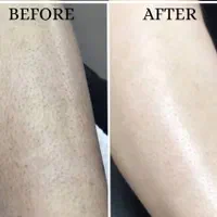 فیشال ولیزر مدیکا ژاندارمری|خدمات آرایشگری و زیبایی|اردبیل, |دیوار