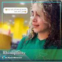 جراحی زیبایی بینی ،گچساران،دکتر نادر موسوی|خدمات آرایشگری و زیبایی|دوگنبدان, |دیوار